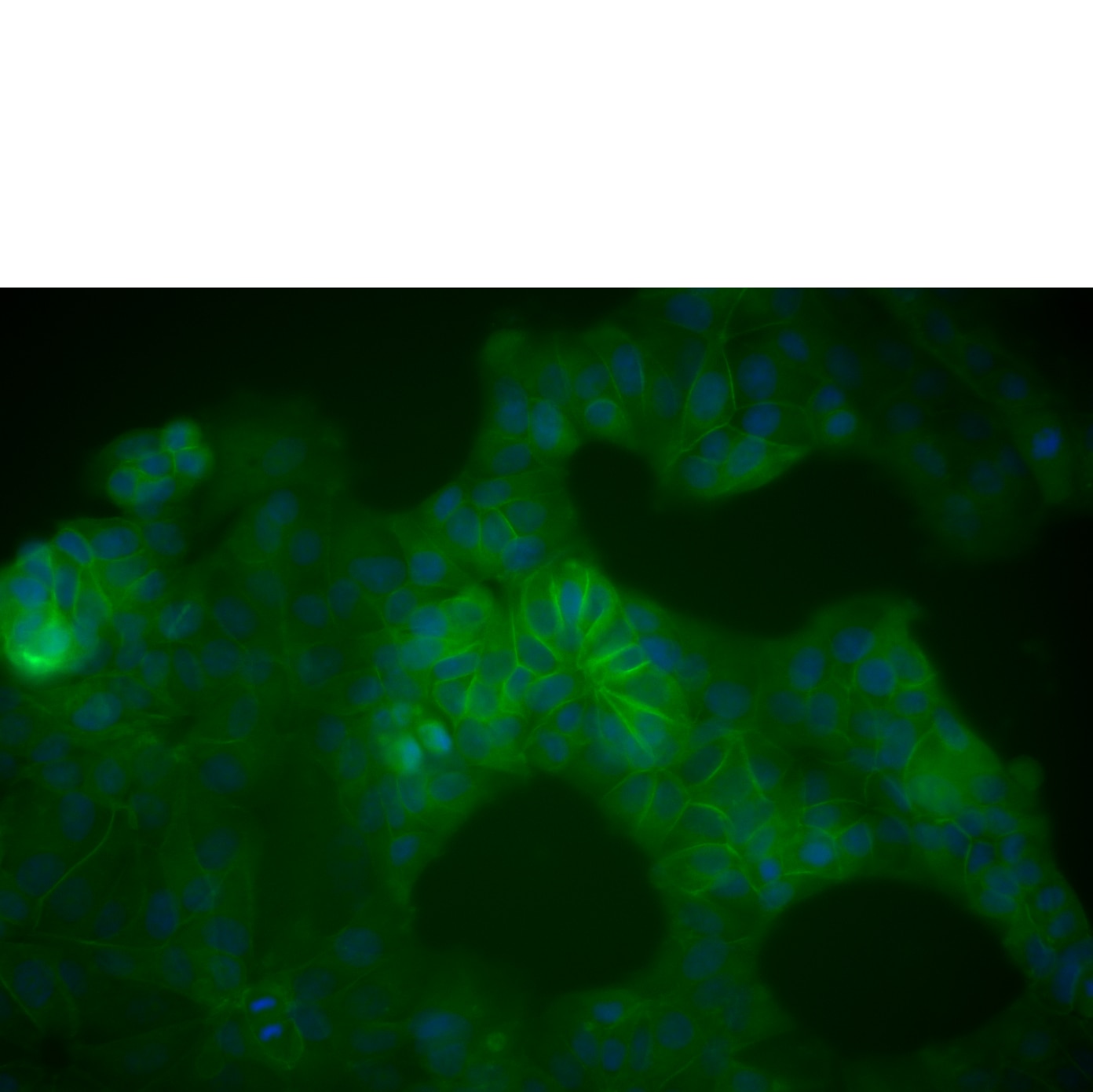 BCatenin_Image_562505.png